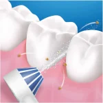Aquacare4  idropulsore ric.2 mod di pulizia   2 testine incl